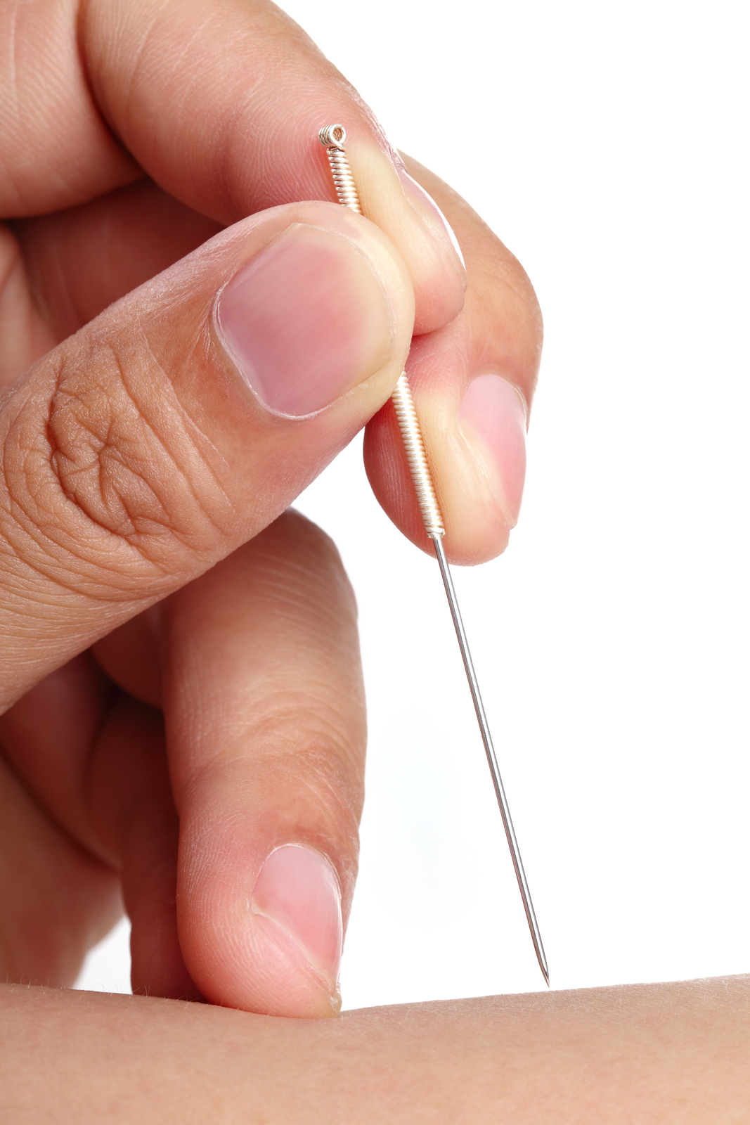 dry needling for neck pain in Katy, TX