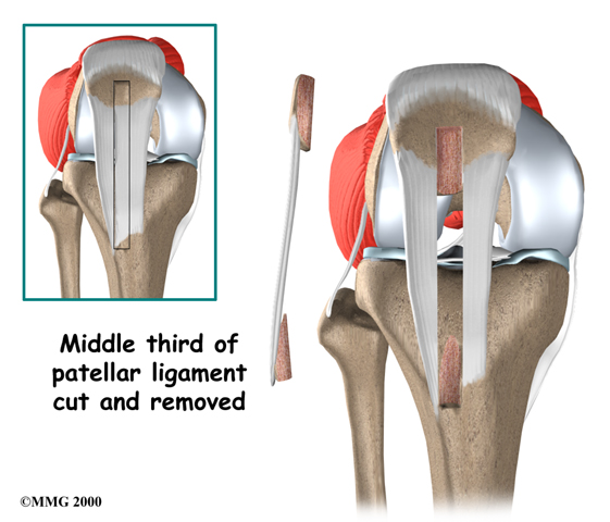 Physical Therapy In Columbia For Anterior Cruciate Ligament Injury Physical Therapy In Columbia For Anterior Cruciate Ligament Injury