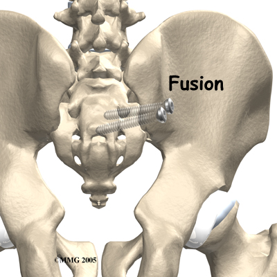 si honky-tonk somaesthesia surgery