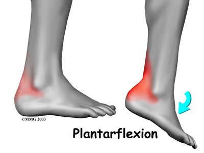 pain in the back of ankle and heel