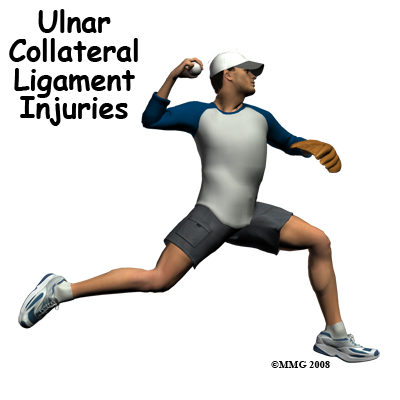 Ulnar Collateral Ligament Injuries