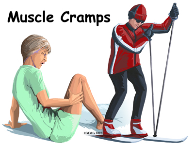 Muscle Cramps