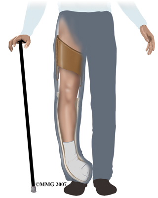 Physical Therapy In El Paso For Pediatric Issues Clubfoot Physical Therapy In El Paso For Pediatric Issues Clubfoot