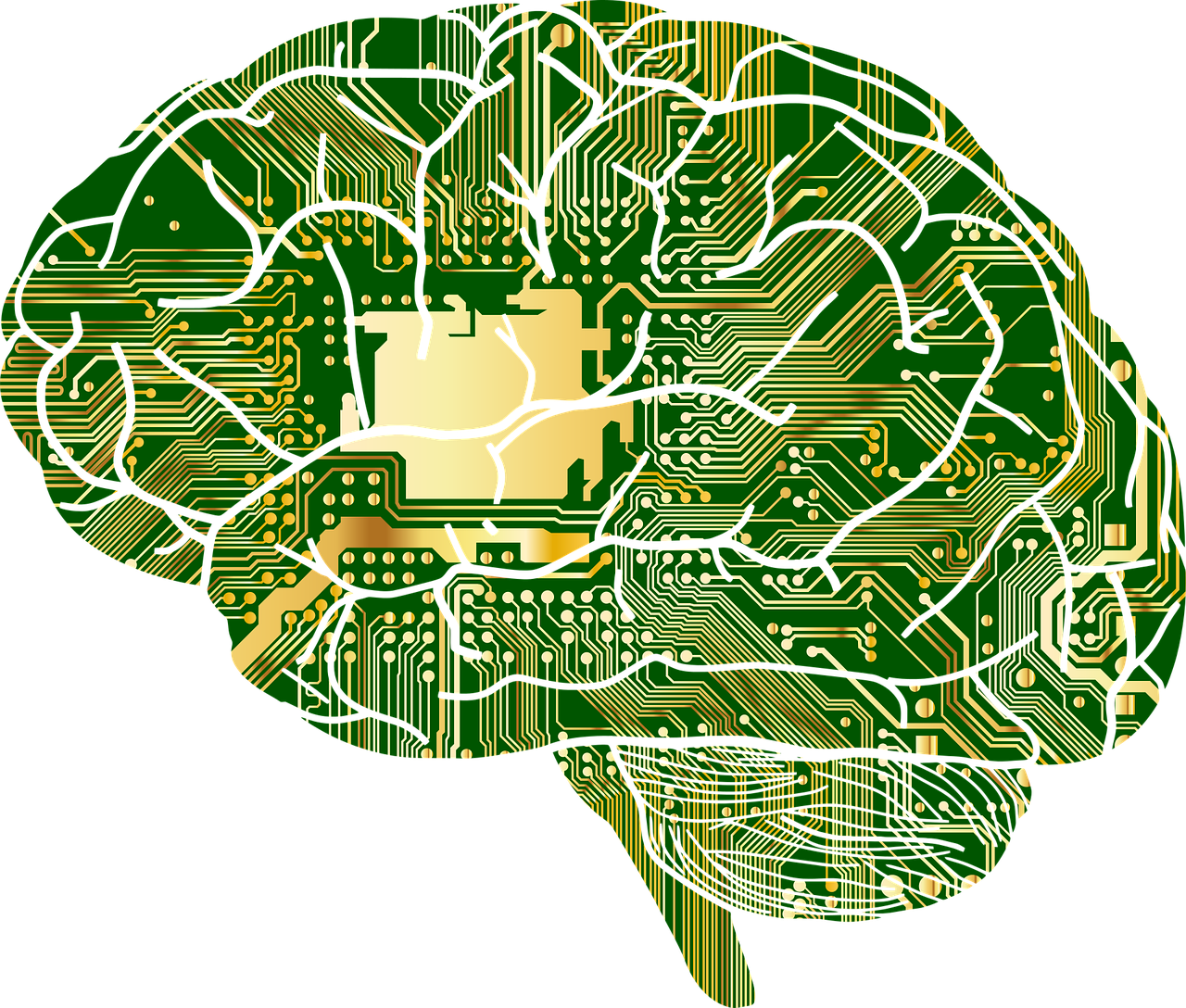 Alzheimer's Brain