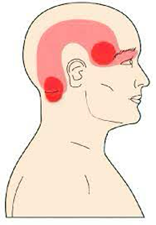 Understanding Headaches: Types, Triggers, and Treatments | Fyzical Orchard