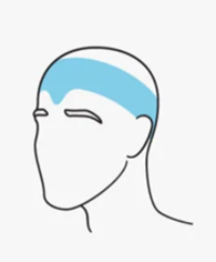 Understanding Headaches: Types, Triggers, and Treatments | Fyzical Orchard