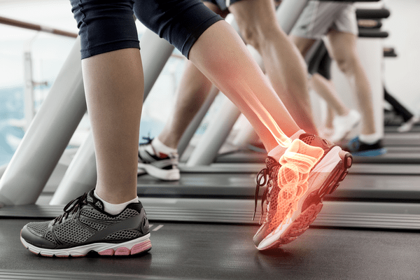 women on a treadmill with foot pain
