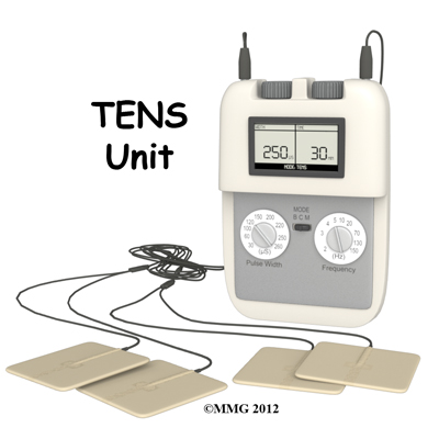 Transcutaneous Electrical Nerve Stimulation (TENS)