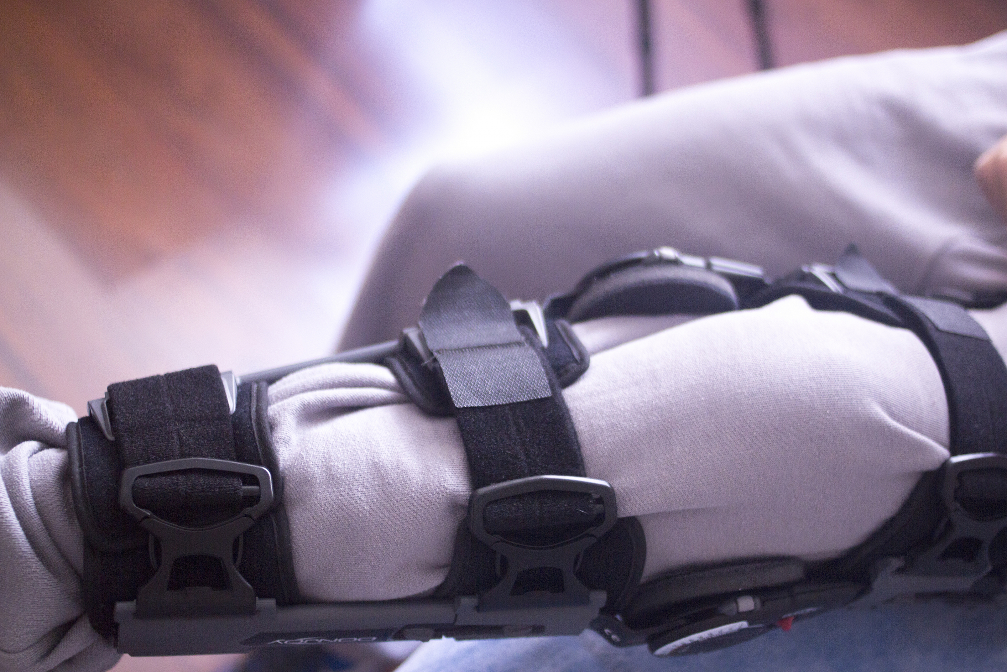 Post Surgical Rehabilitation in Woodstock, GA